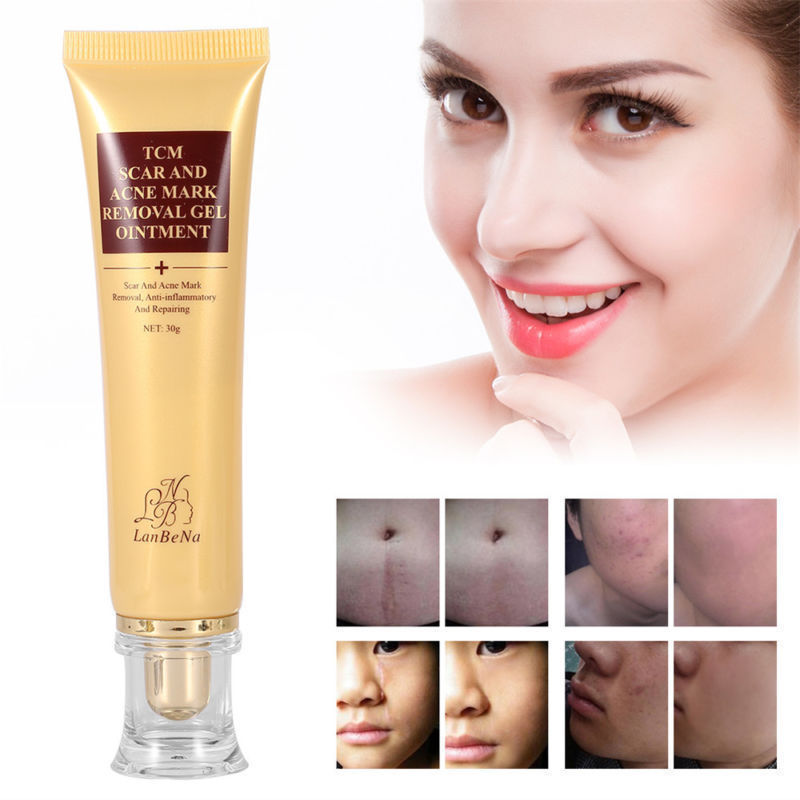 Creme Removedor de Cicatrizes e Acne - TCM - MG Shop Store